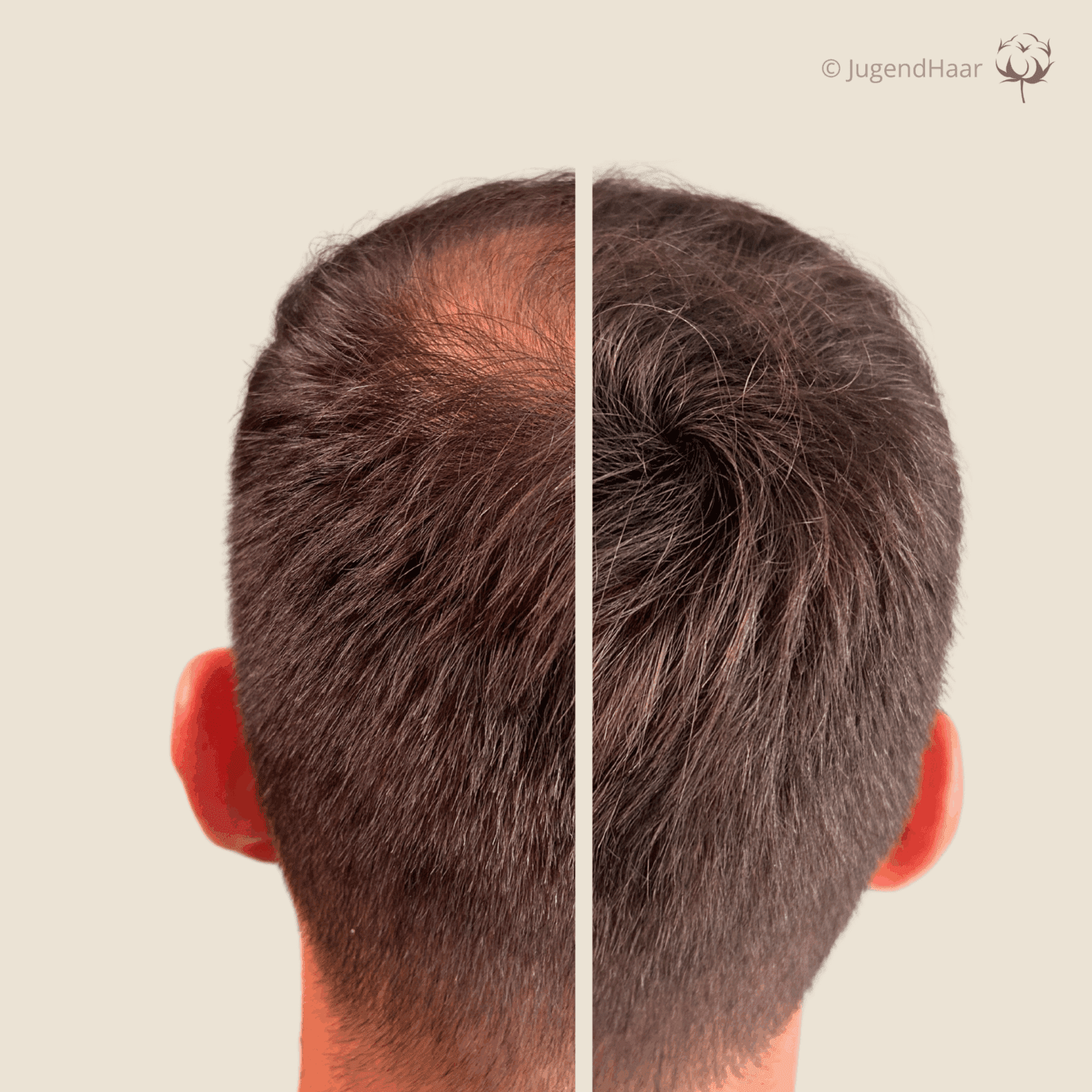 JugendHaar Streuhaar-Effekt Vorher Nacher Produkt