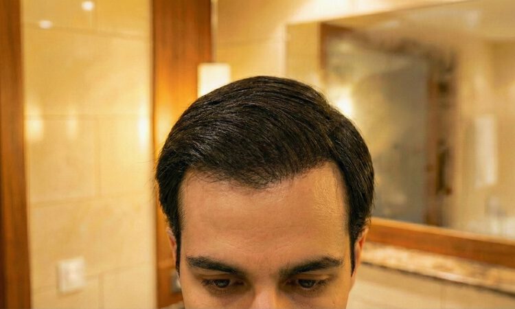 JugendHaar_Nacher_Effekt_Dunkelbraun