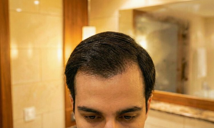 JugendHaar_Vorher_Effekt_Dunkelbraun