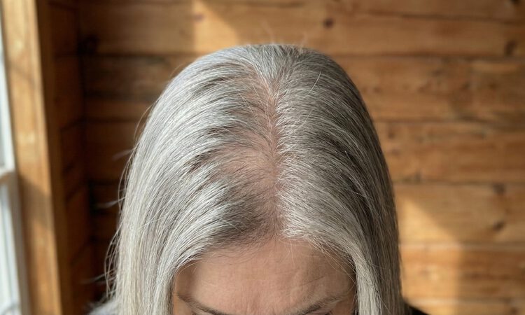 JugendHaar_Vorher_Effekt_Weißgrau